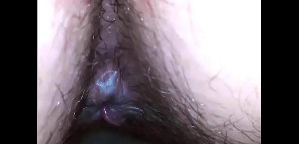  Amazing endoscope dirty asshole exploration and pee are you ready